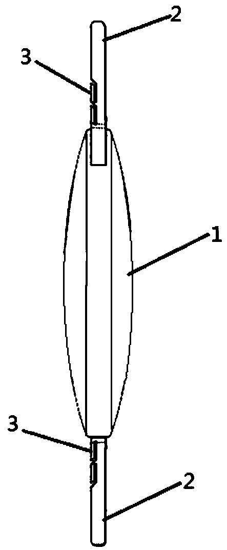 Anterior capsule opening auxiliary fixed artificial lens