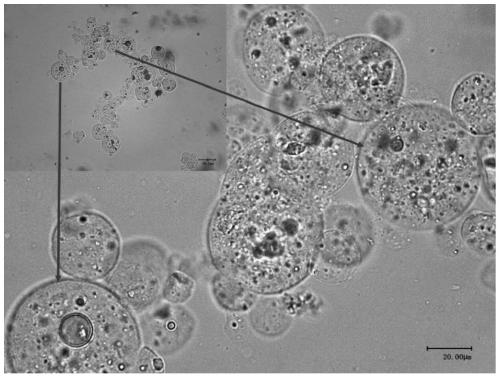 Protein microcapsules for targeted inhibition of small intestinal amylase and preparation method