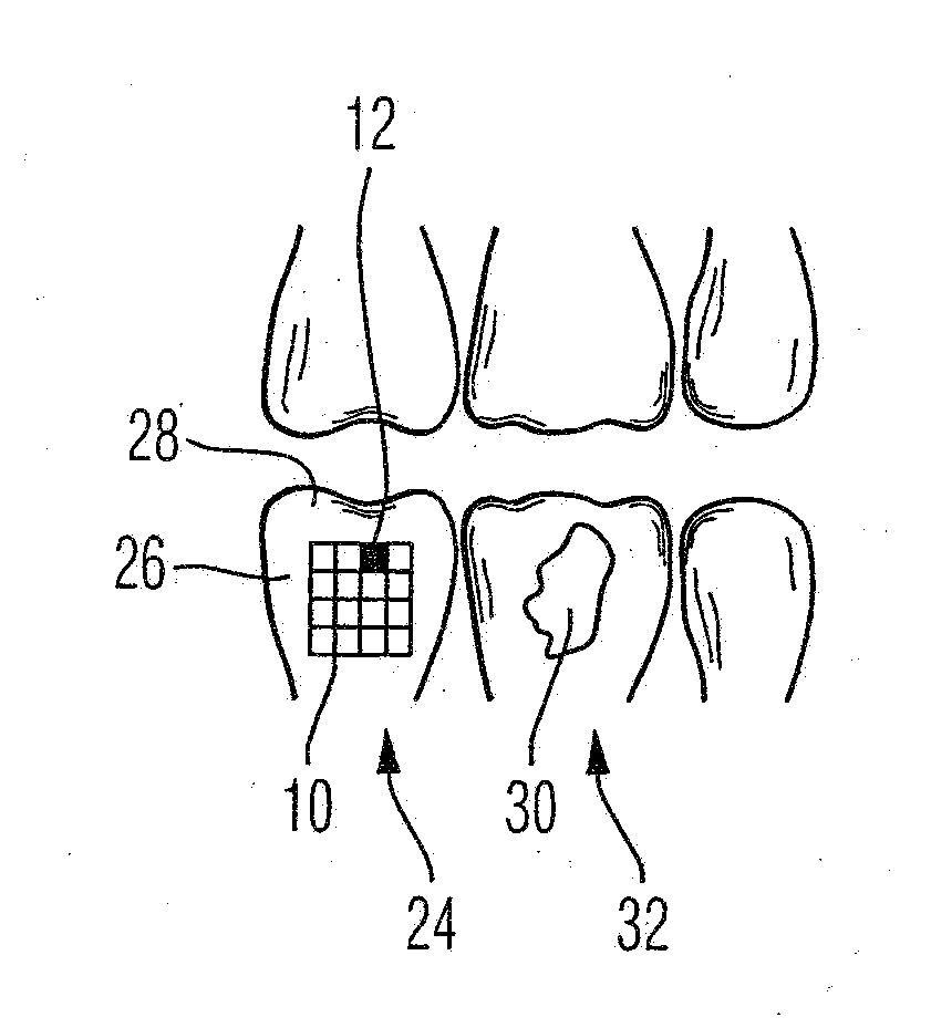 Dental Color Analyzing Device and Methof of Use