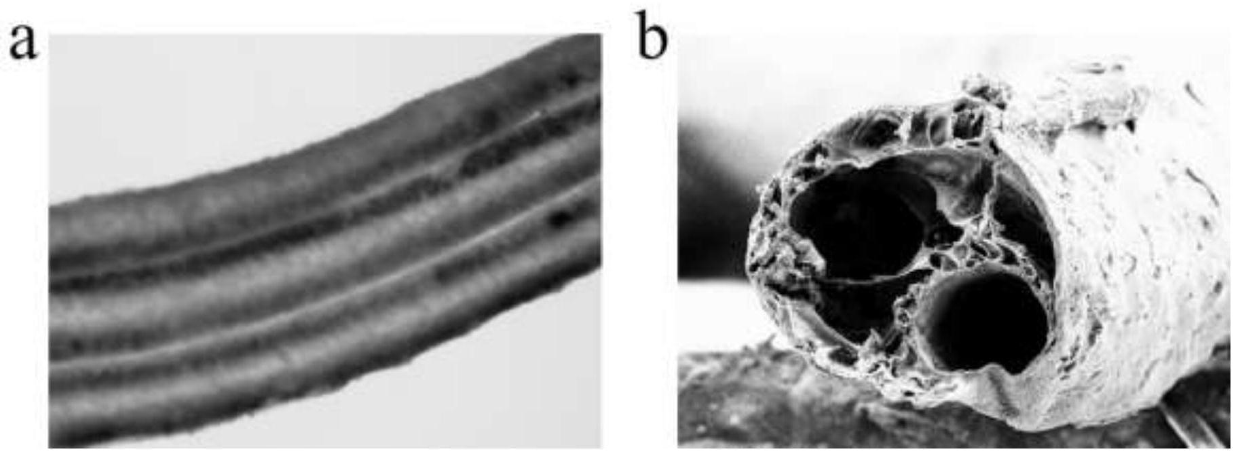 Preparation method and application of bionic multi-component fiber