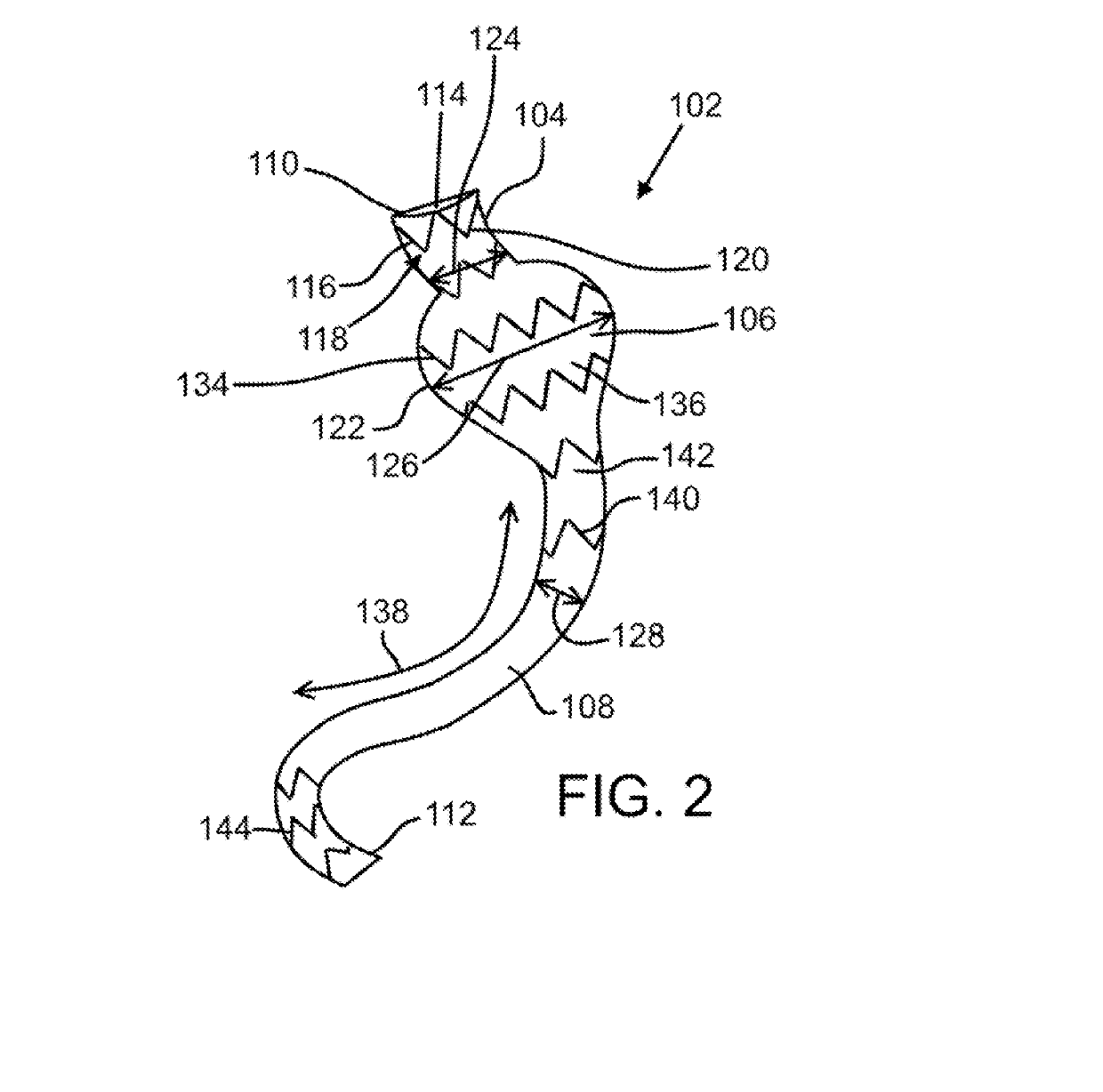 Gastric bypass device