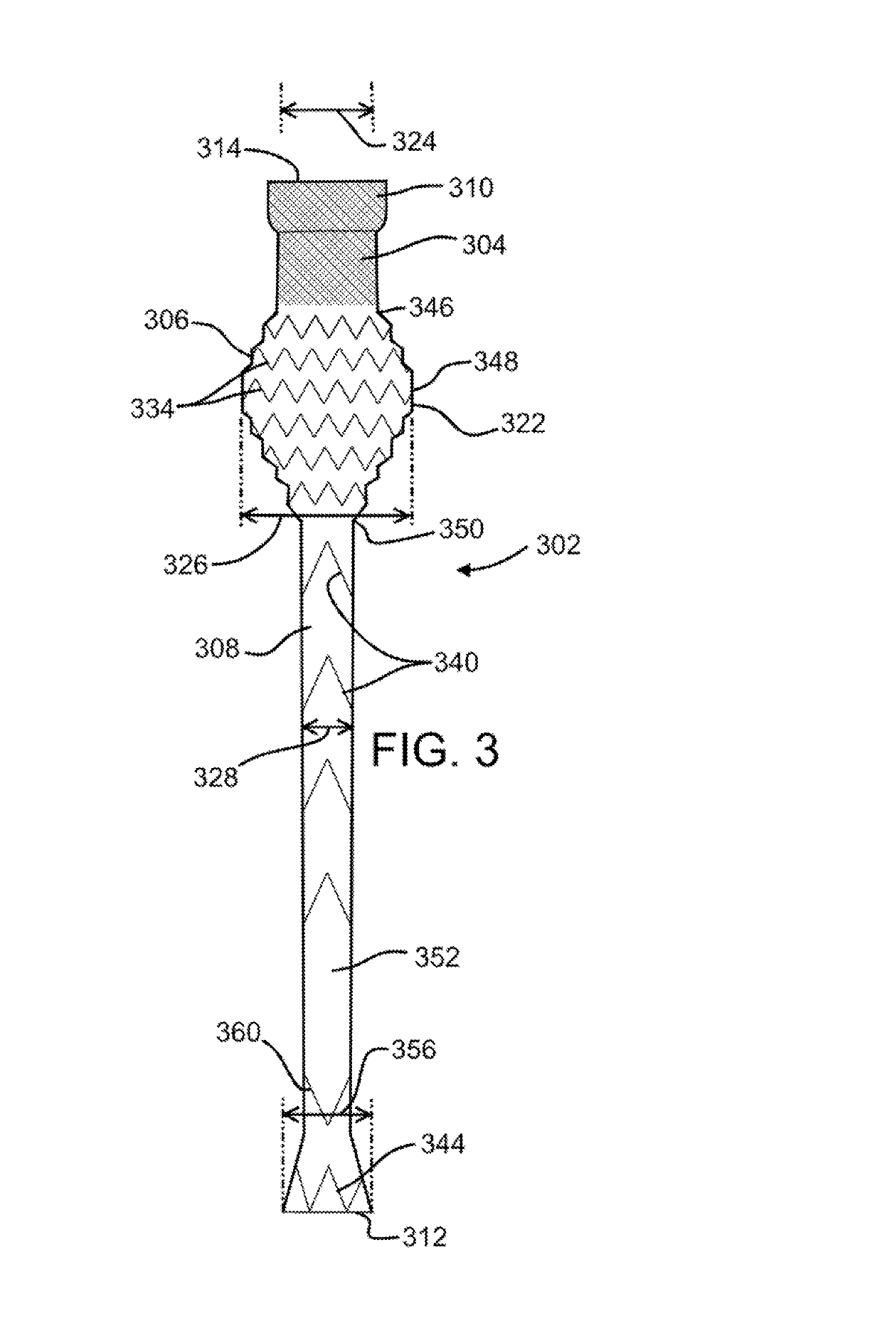 Gastric bypass device