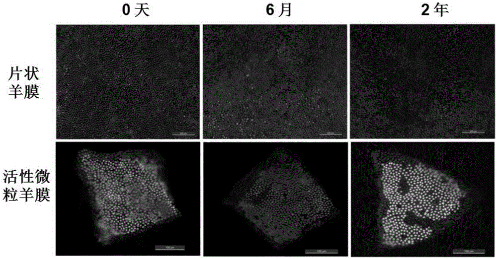 Amnion innate stem cell carried frozen active amnion particle and conditioned medium and application thereof