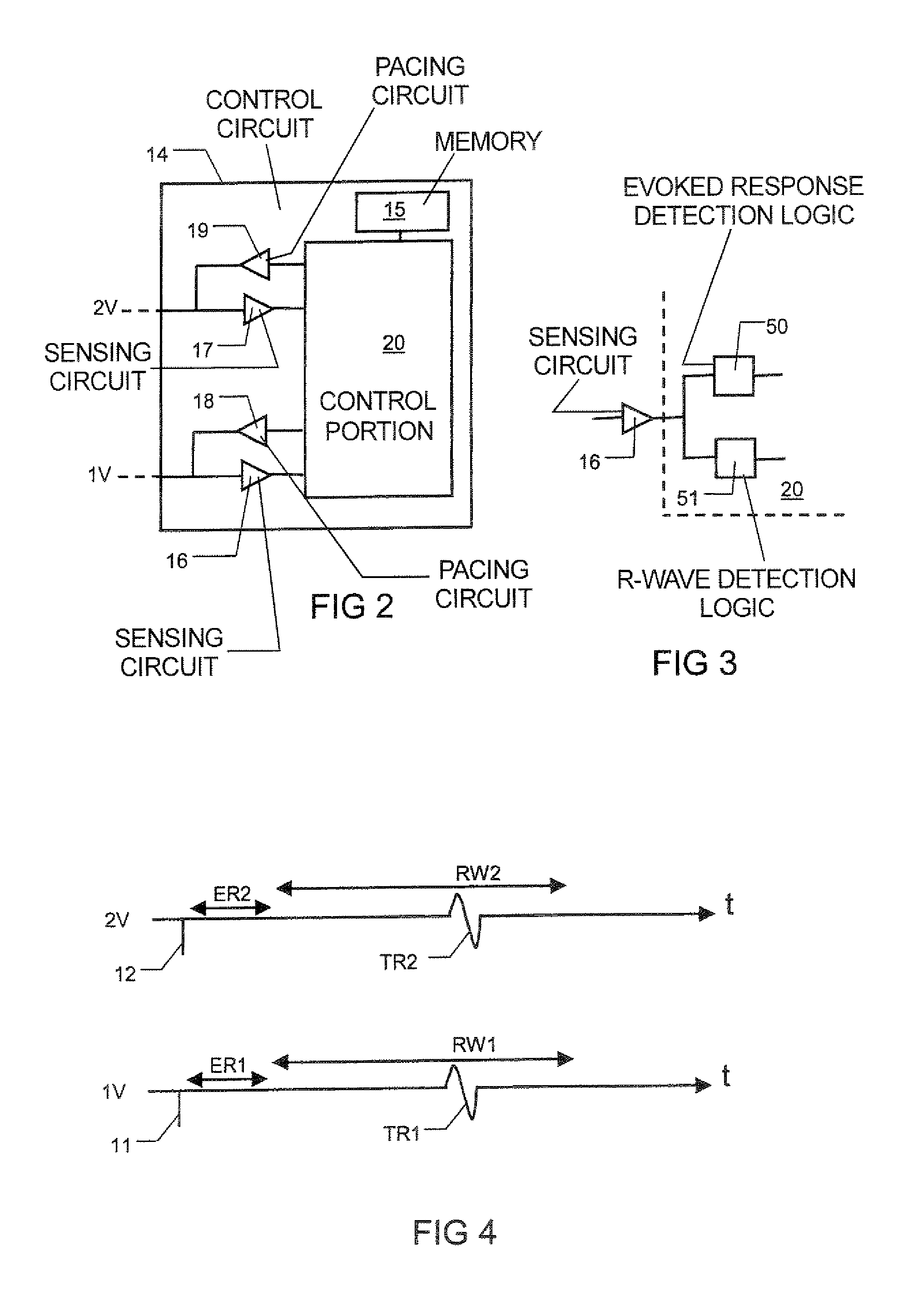 Bi-ventricular pacer, system and method