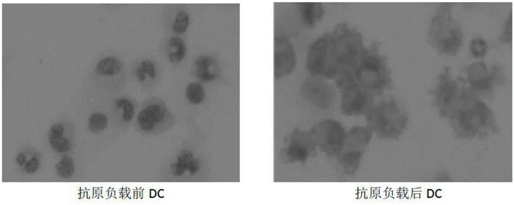 Preparation method of cytotoxicity-enhanced efficient target killing NK/CIK (Natural Killer)/( Cytokine Induced Killer) cells