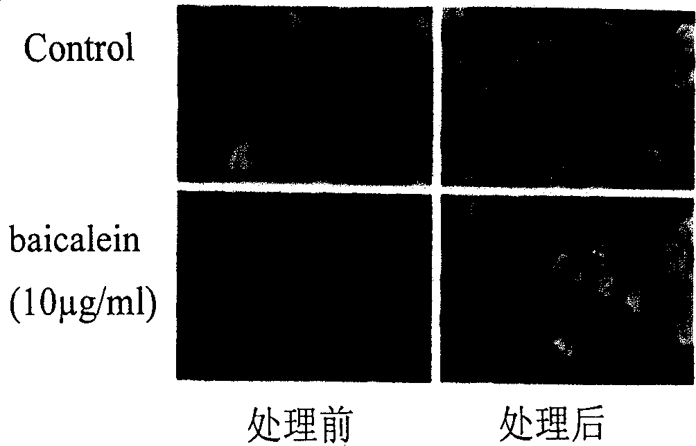 Application of scutellaria root extract in preparation of anti esophageal cancer medicine