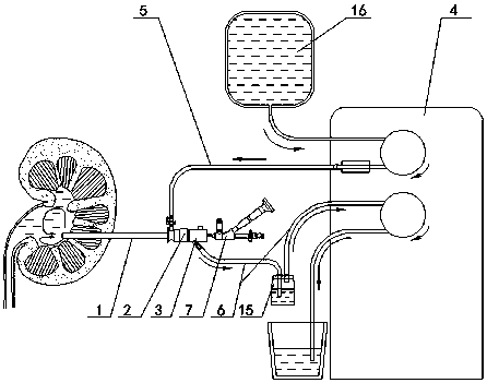 Percutaneous nephrolithotripsy calculus removing method and system