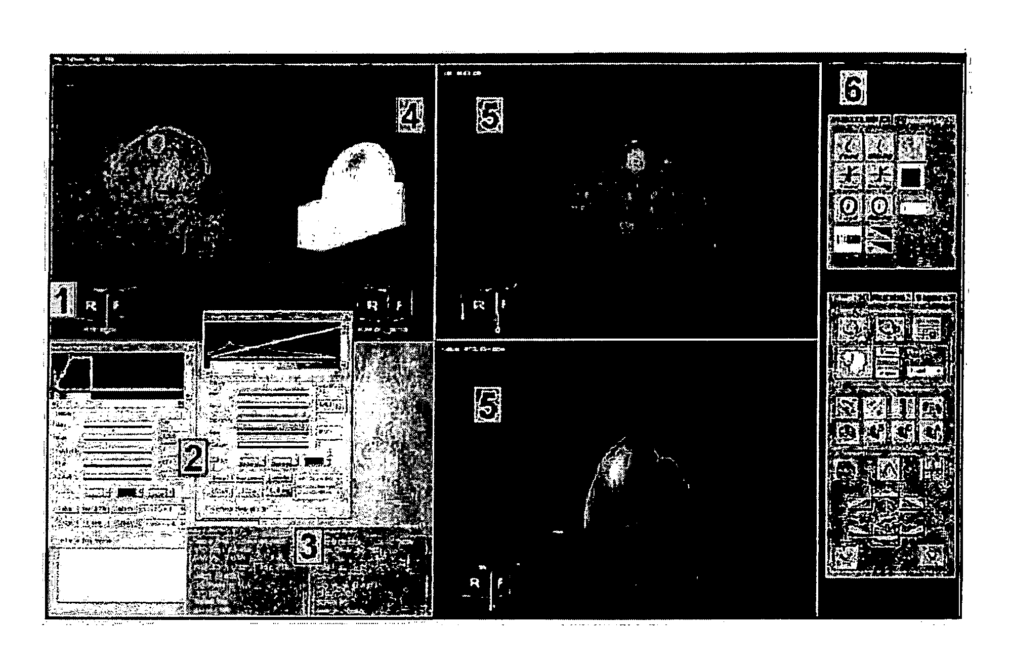 System and method for coregistration and analysis of non-concurrent diffuse optical and magnetic resonance breast images