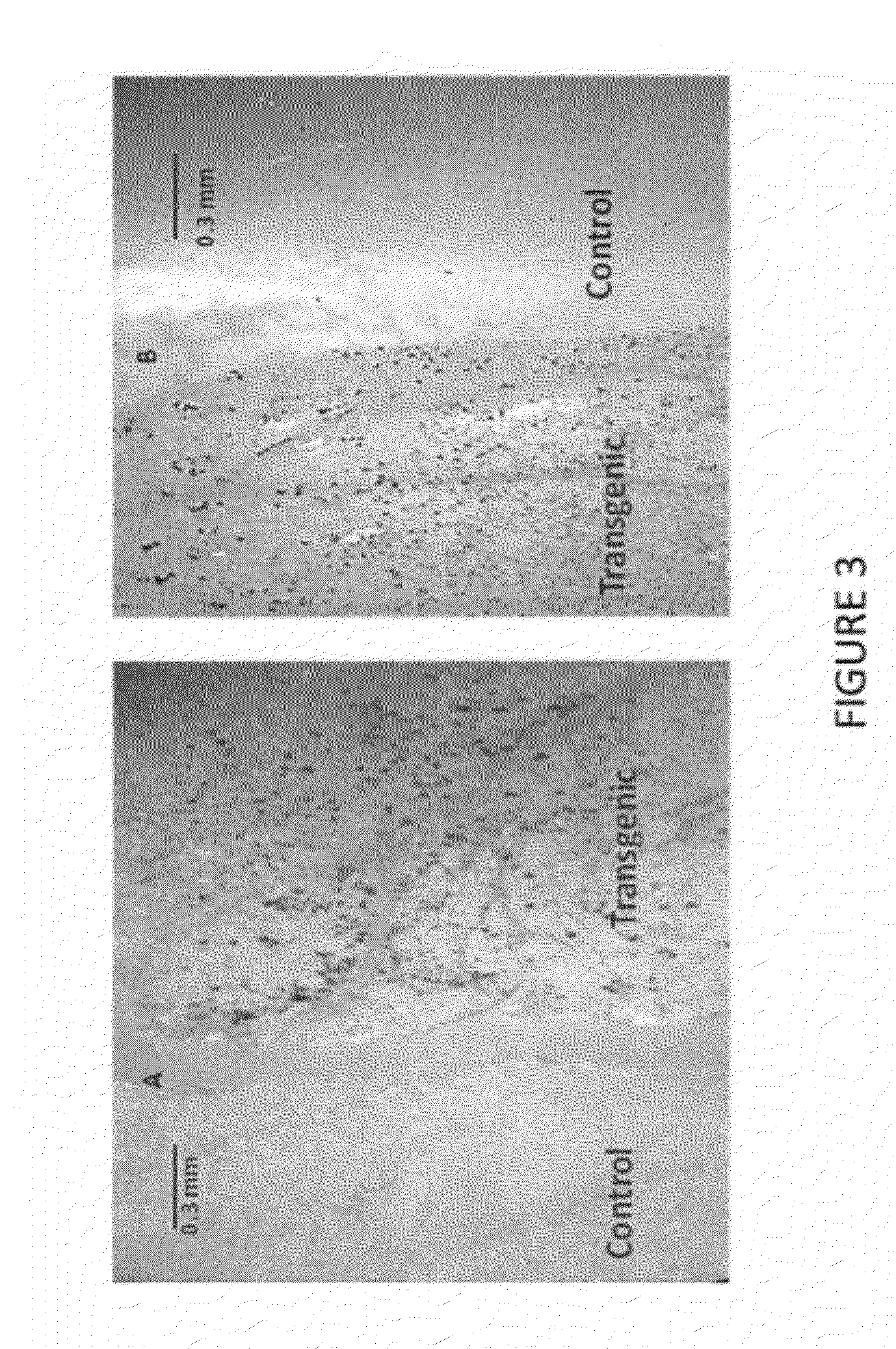 Stably transformed ferns and related methods