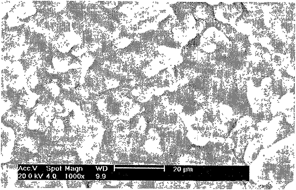 Method for fixing beta-glucuronidase by alginate-calcium carbonate hybrid gel