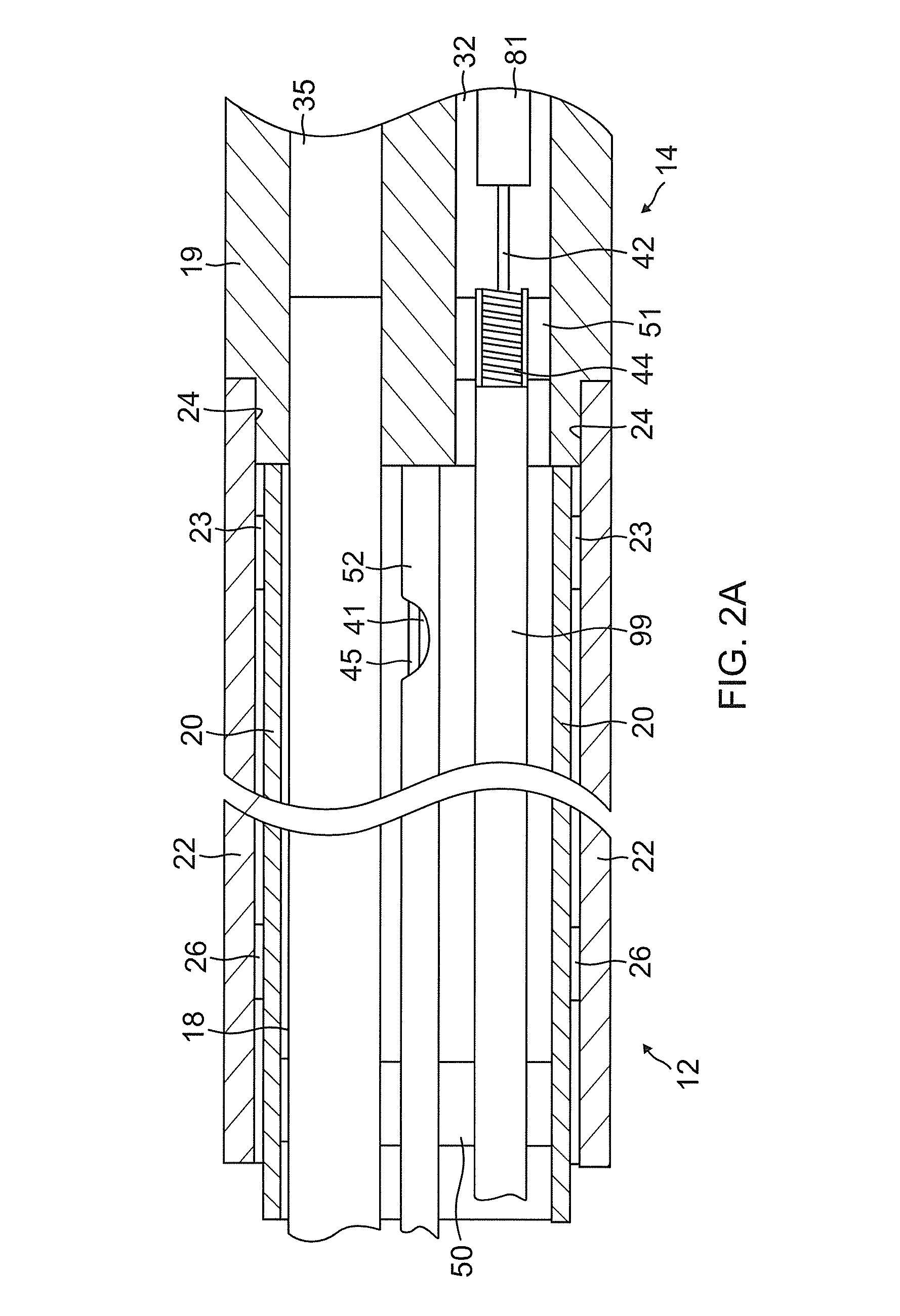 Irrigated catheter with improved irrigation flow