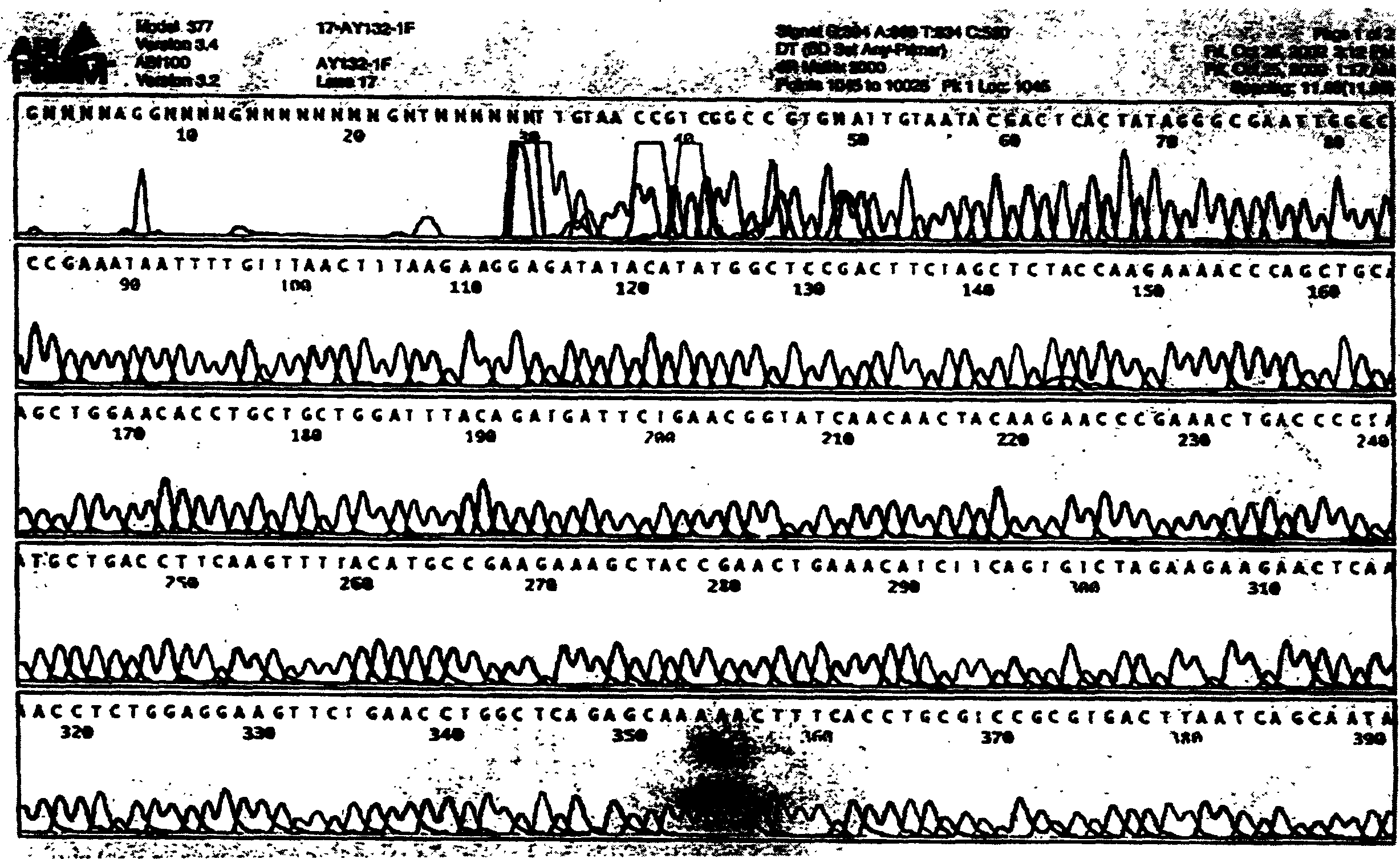 Interleukin-2 mutation gene and its preparation