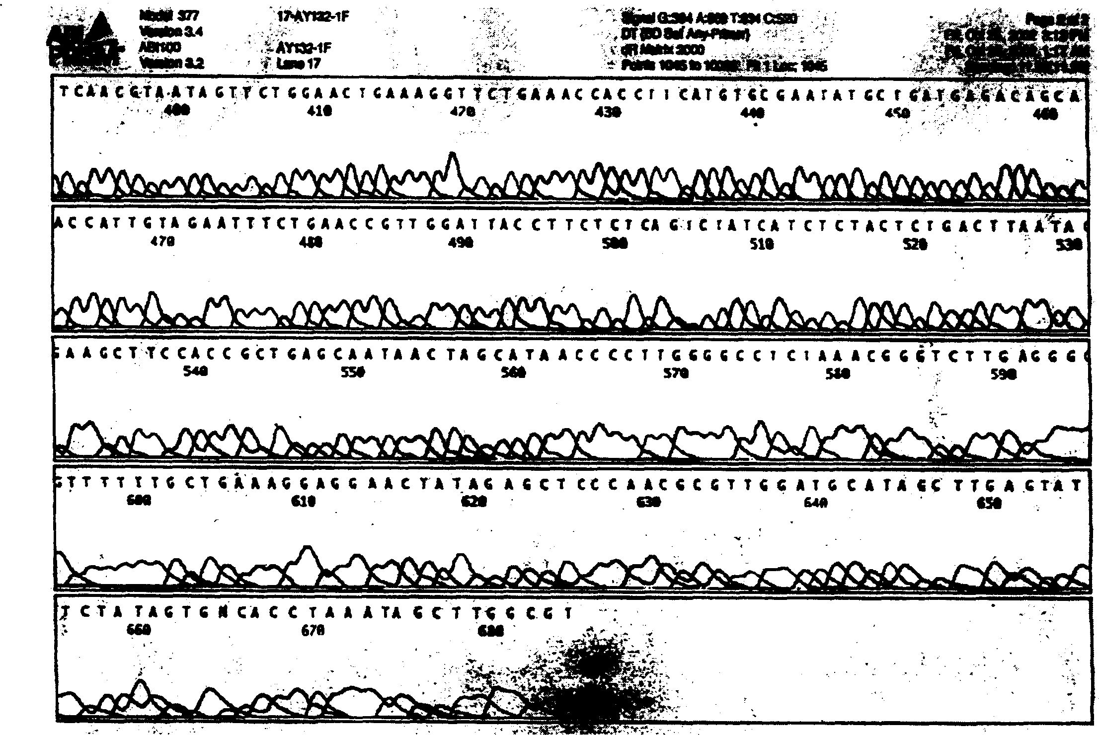 Interleukin-2 mutation gene and its preparation