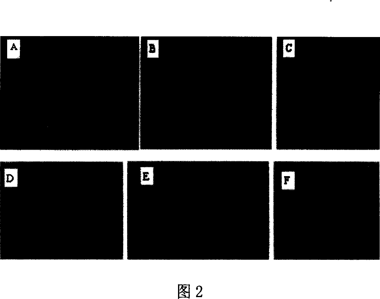 Henpox virus universal transfer carrier, recombination henpox virus and its preparation method