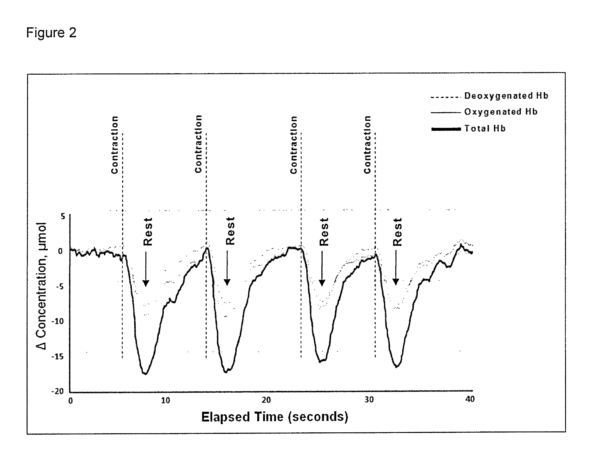 Monitoring urodynamics by trans-vaginal NIRS