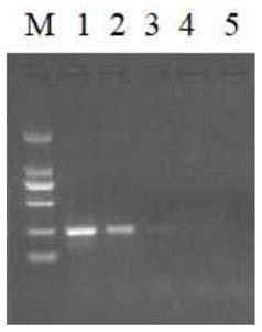 Recombinant polymerase isothermal amplification detection method of hepatitis B viruses in ducks