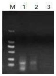 Recombinant polymerase isothermal amplification detection method of hepatitis B viruses in ducks