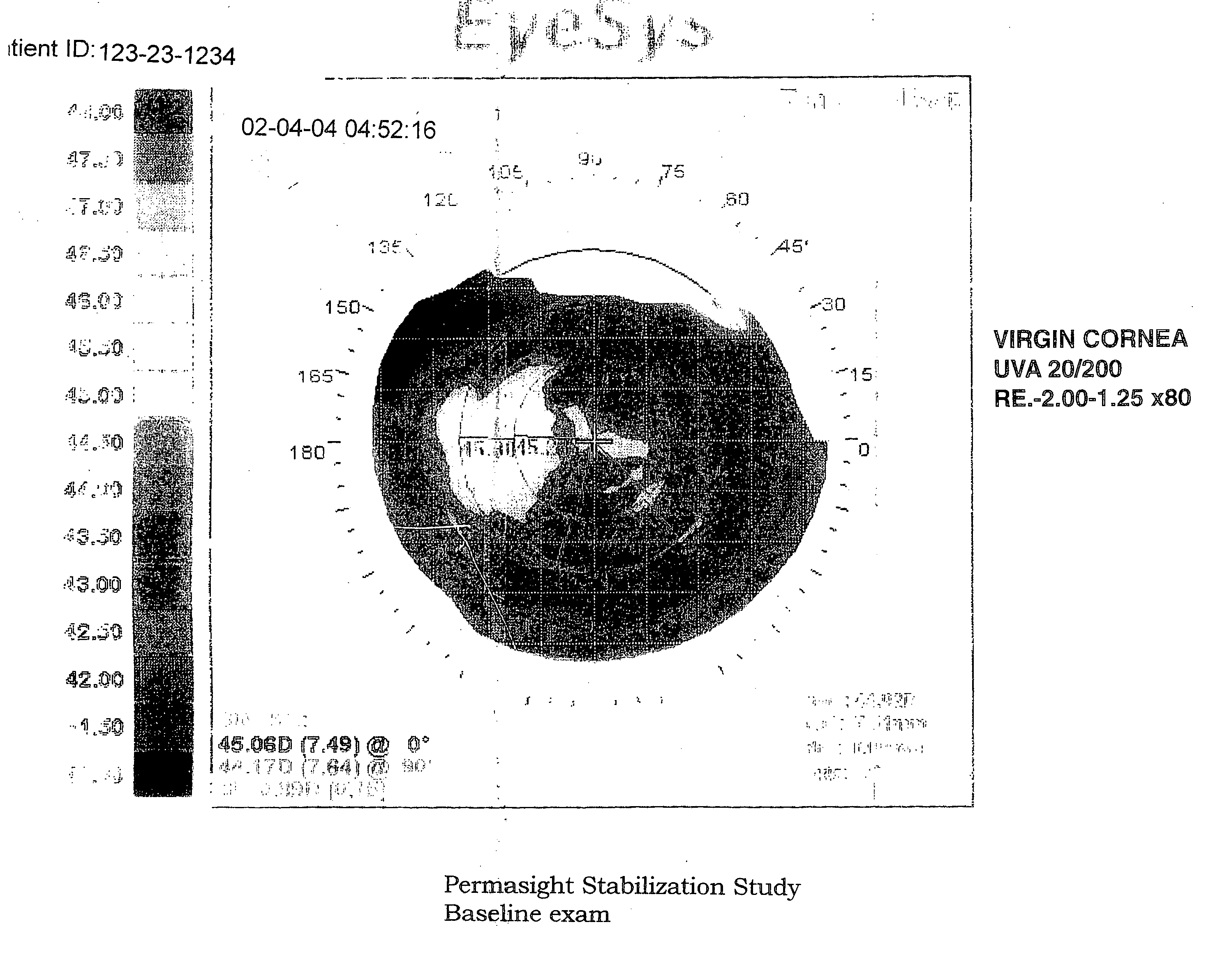 Method for stabilizing changes in corneal curvature in an eye by administering compositions containing stabilizing ophthalmic agents