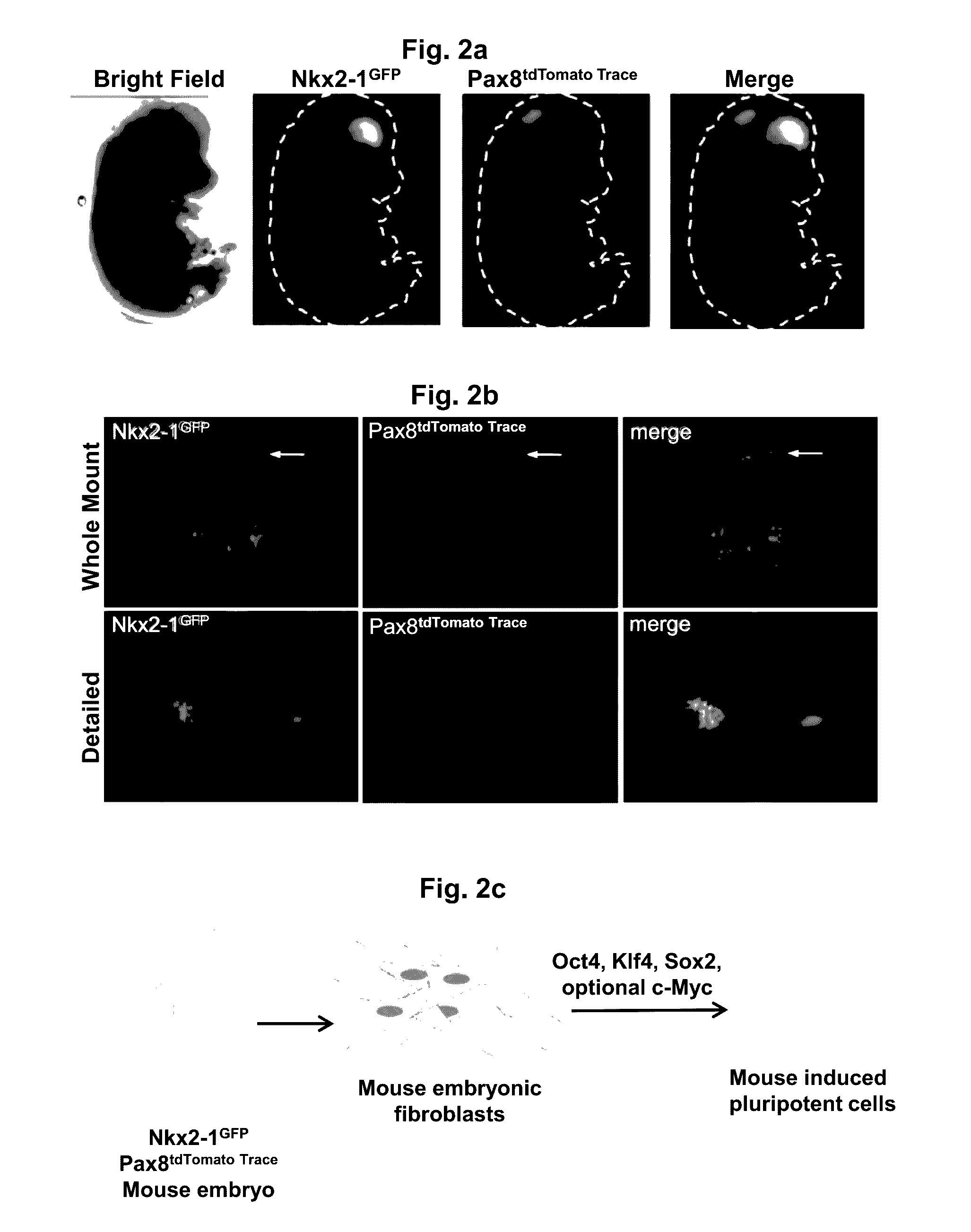 Differentiation of stem cells into thyroid tissue