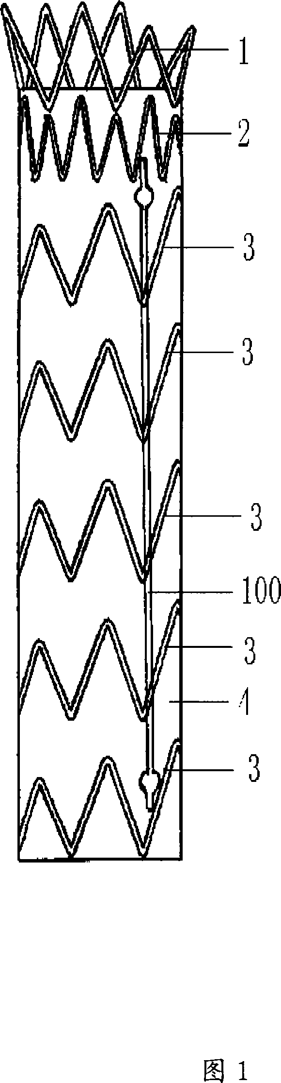 Tectorial bracket