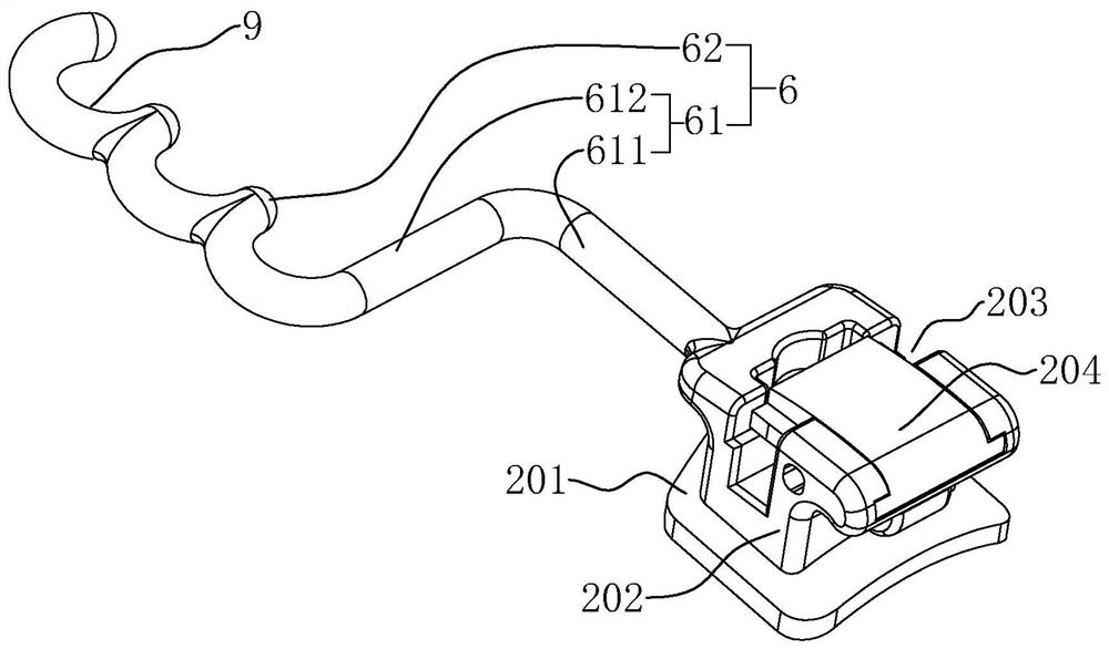 an orthodontic component