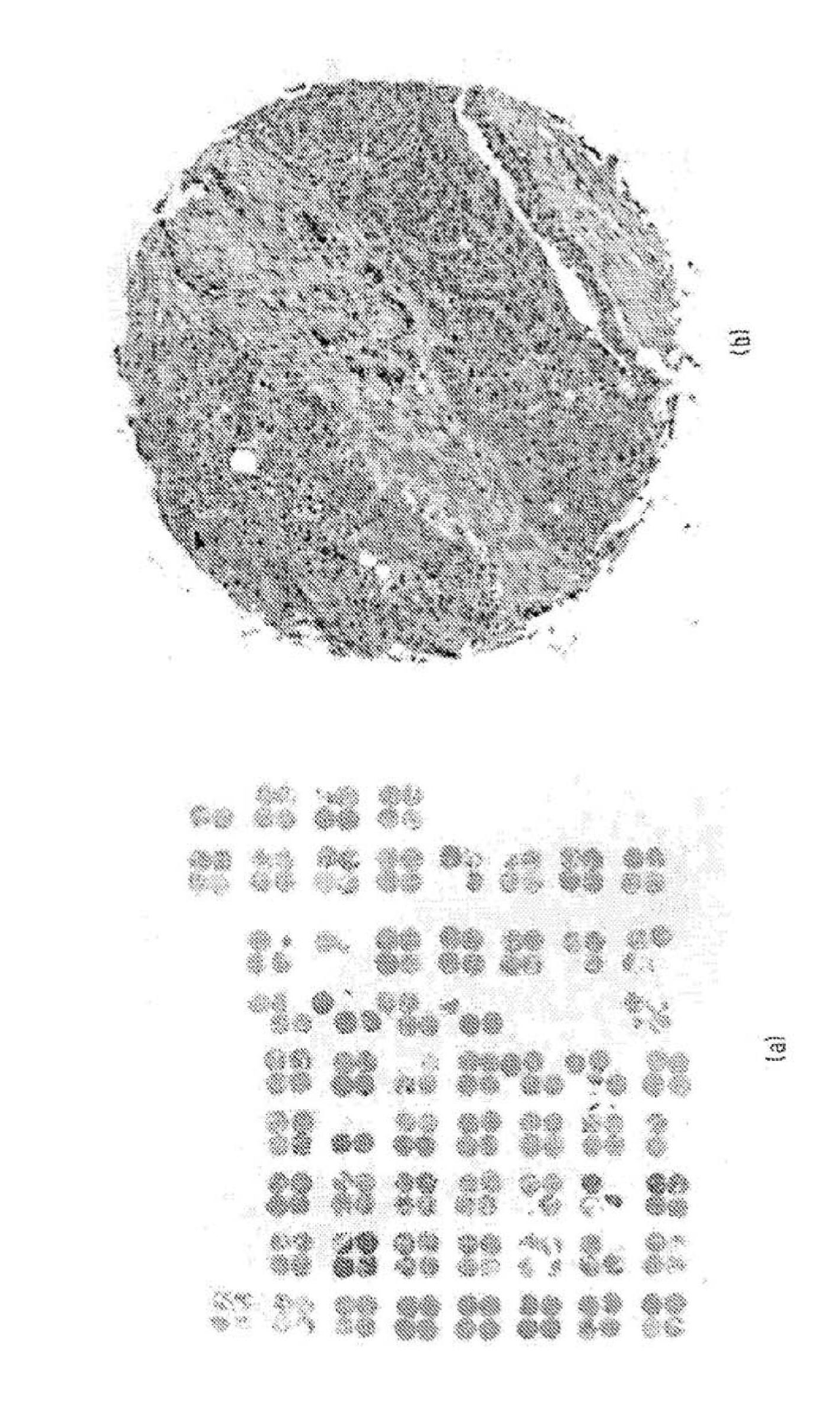 High-throughput biomarker segmentation utilizing hierarchical normalized cuts