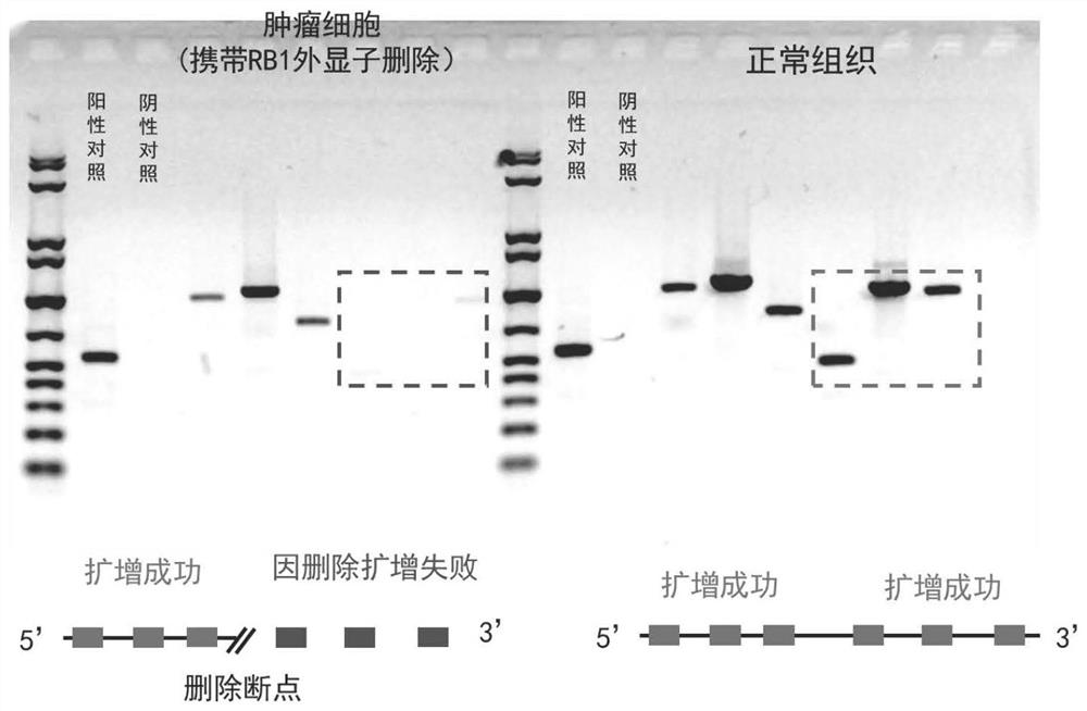 PCR primer group, kit and application thereof