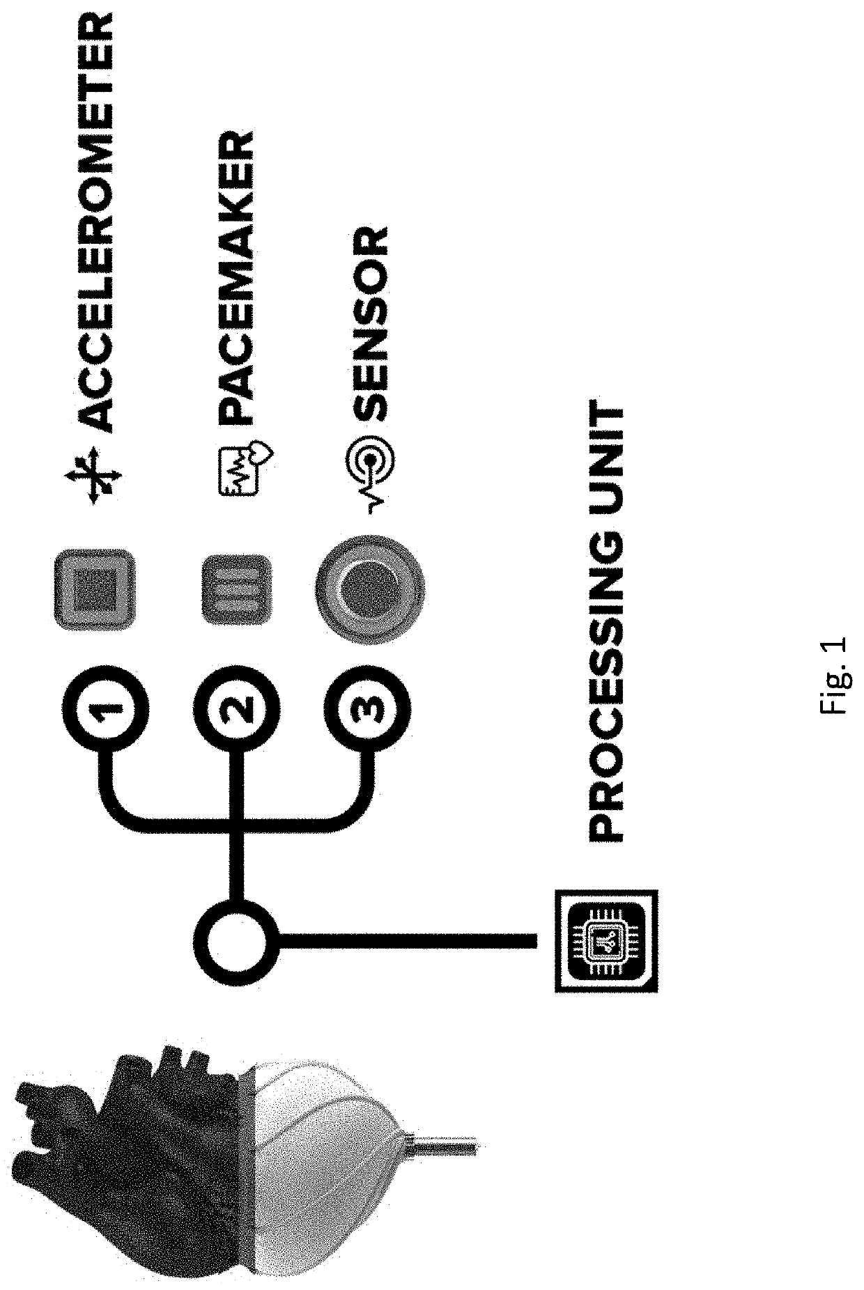 System of epicardial sensing and pacing for synchronizing a heart assist device