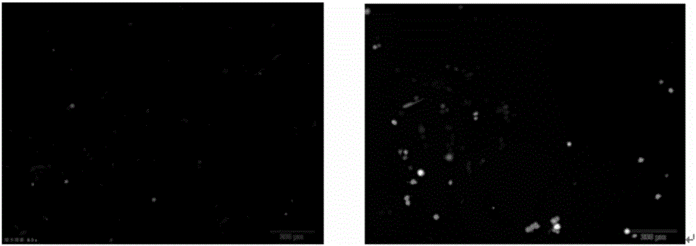 Serum-free medium and method for culturing mesenchymal stem cell