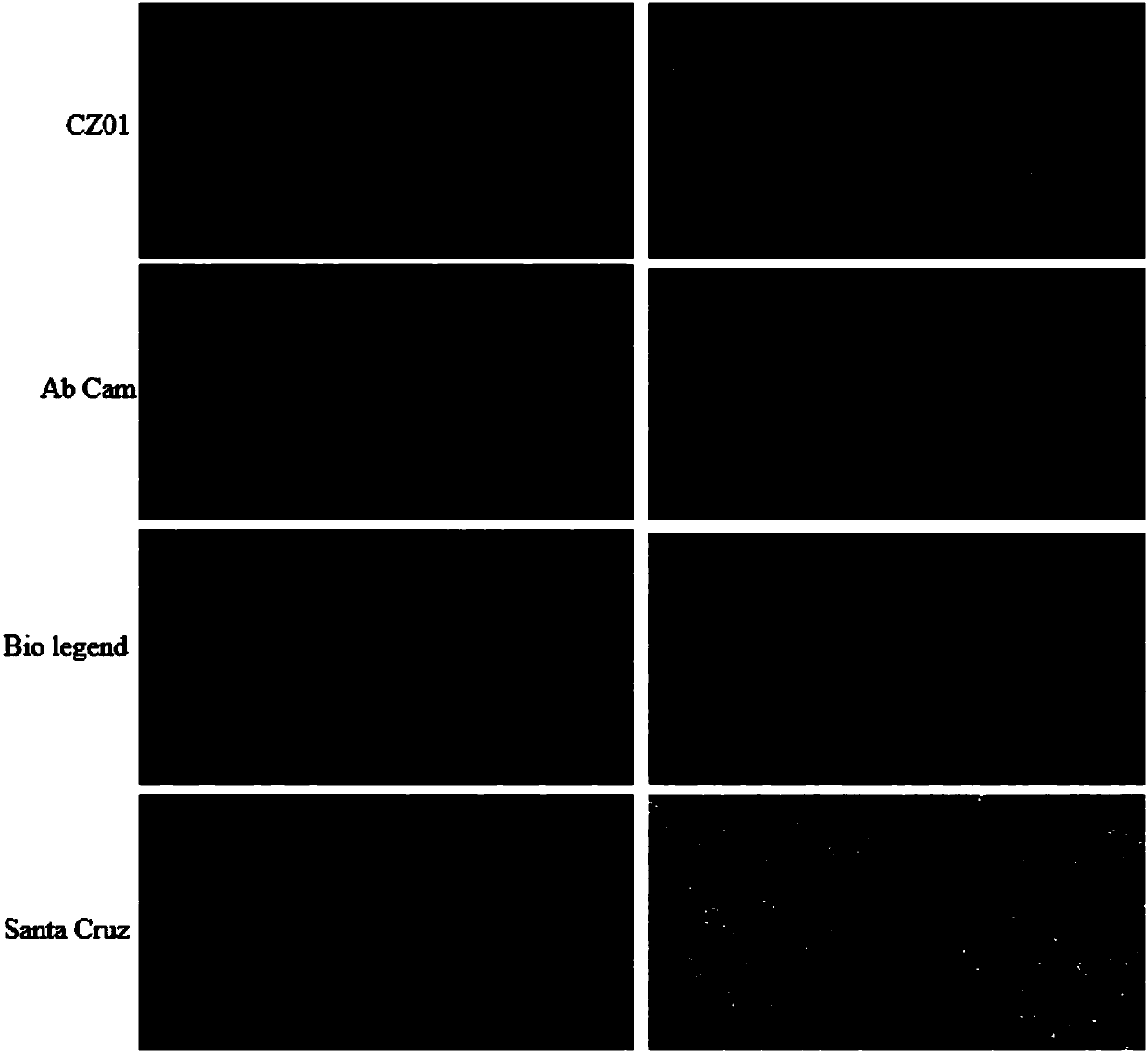 Detection kit and detection method of circulating tumor cells