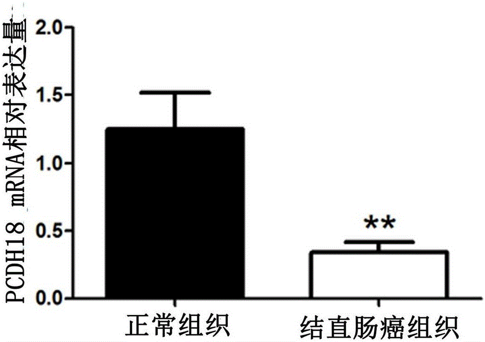 Application of PCDH18 gene to preparation of colorectal cancer diagnosis kit and kit