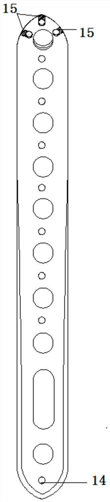 Ulna far-end inner side bone fracture plate