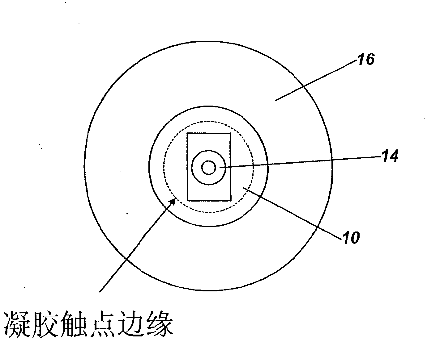 Electrode and electrode positioning arrangement for abdominal fetal electrocardiogram detection