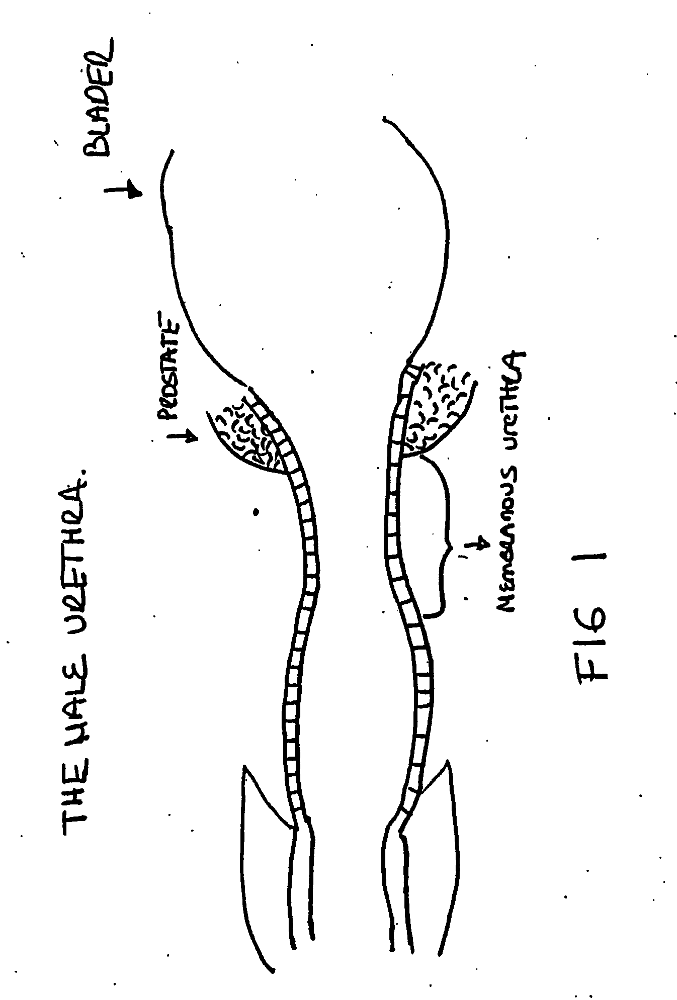 Augmentation and repair of spincter defects with cells including adipocytic cells