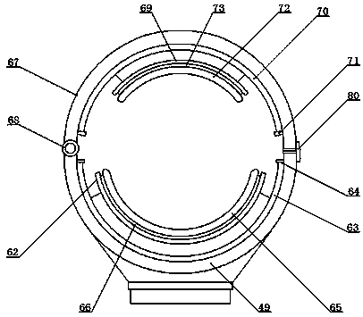 Cervical disease examining and sampling device used in gynecology department