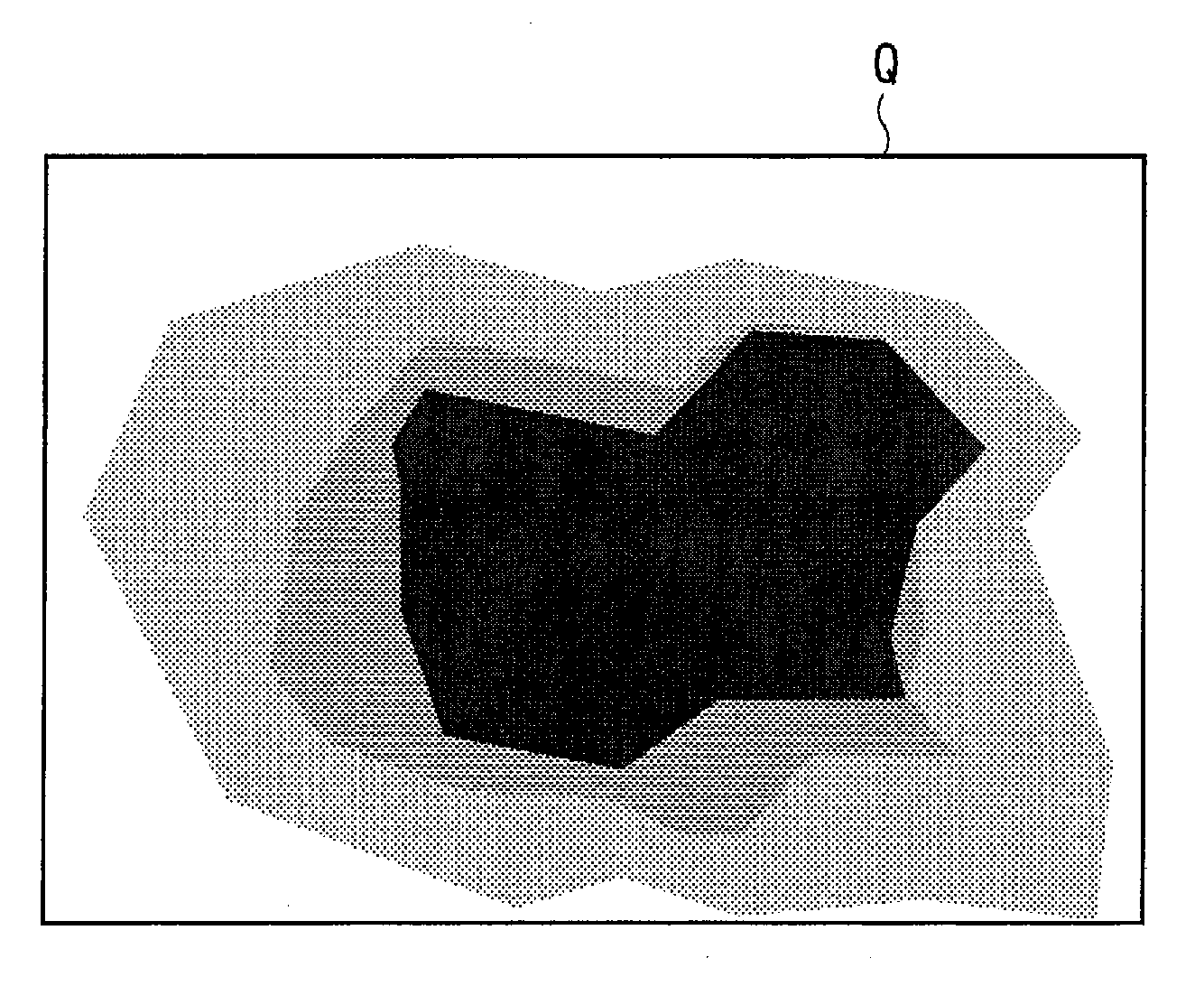 Contour extraction device and program