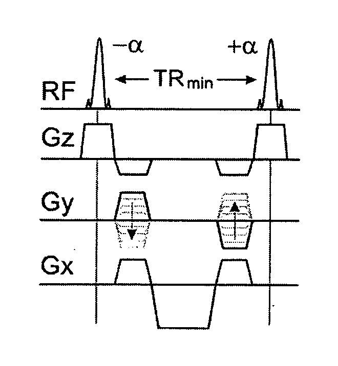 Method and apparatus for generation of magnetization transfer contrast in steady state free precession magnetic resonance imaging