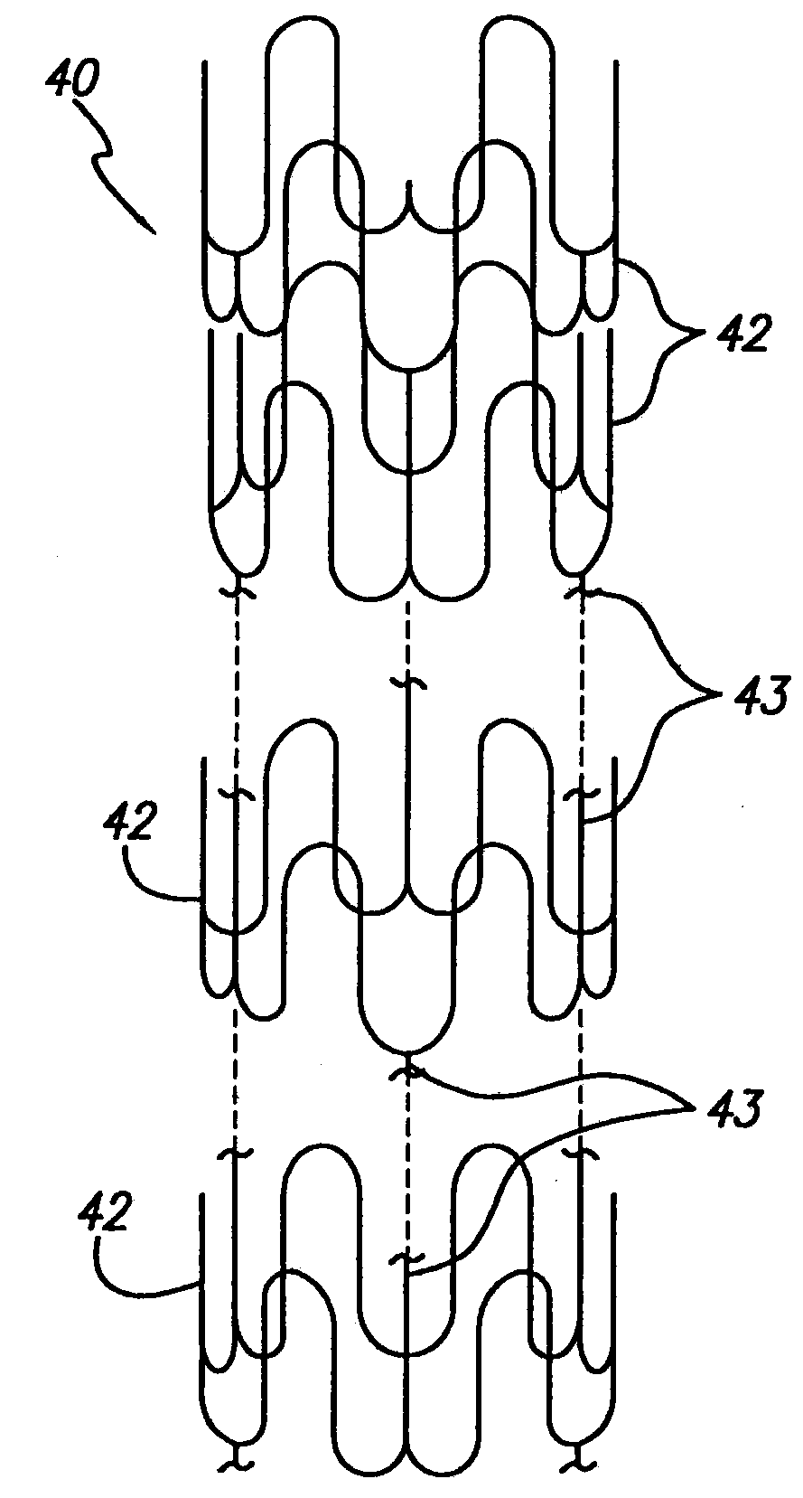 Multilayer stent