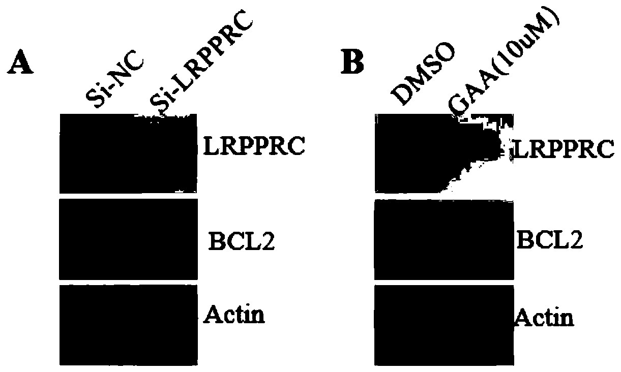 Combined drug of gossypol acetate and chemotherapeutic drug