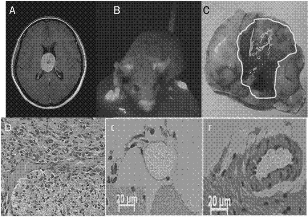 Preparation method of enhanced green fluorescence SCID mice model and model application