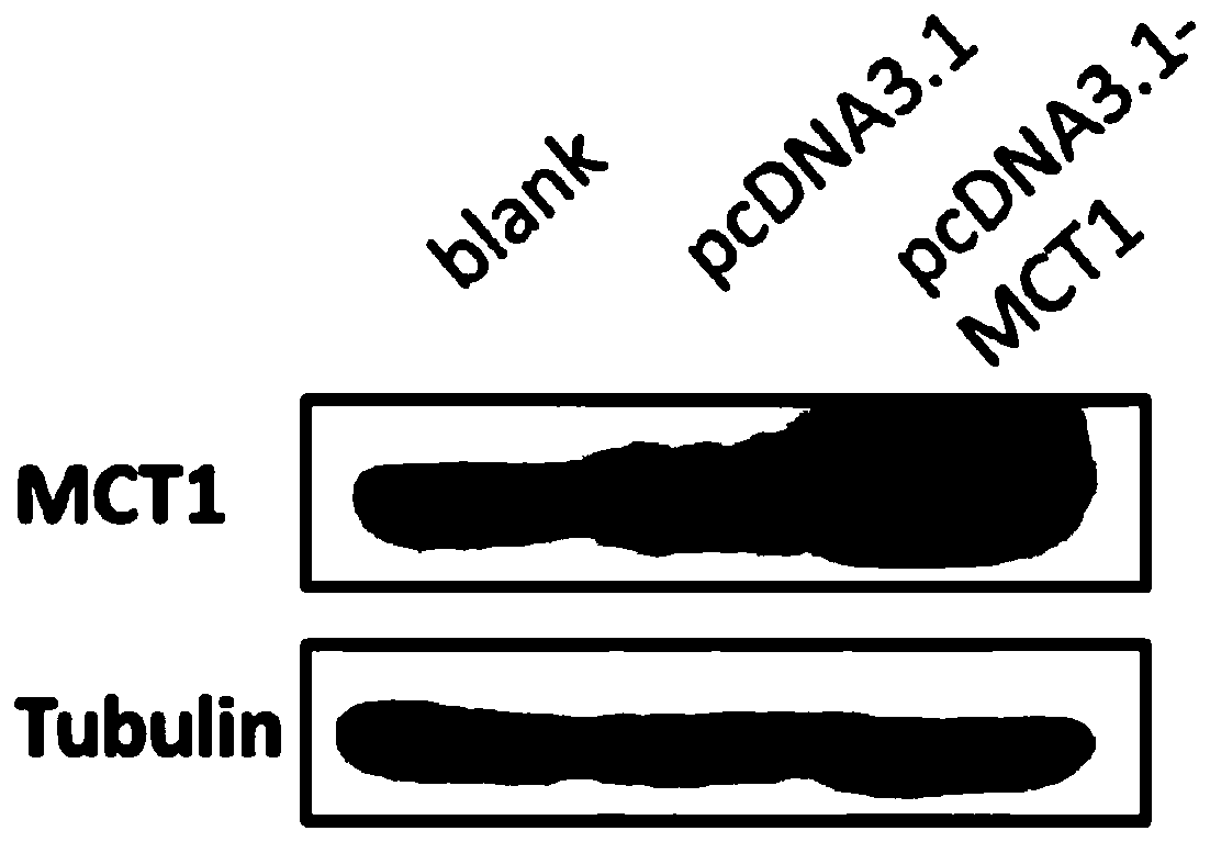 Application of MCT1 inhibitor and pharmaceutical composition containing the MCT1 inhibitor