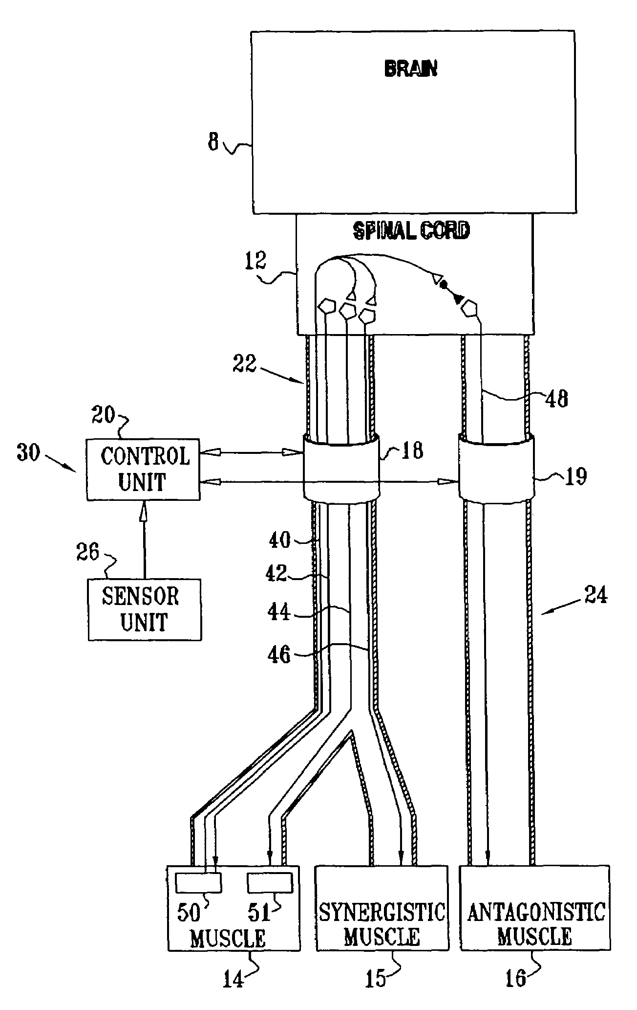 Nerve stimulation for treating spasticity, tremor, muscle weakness, and other motor disorders