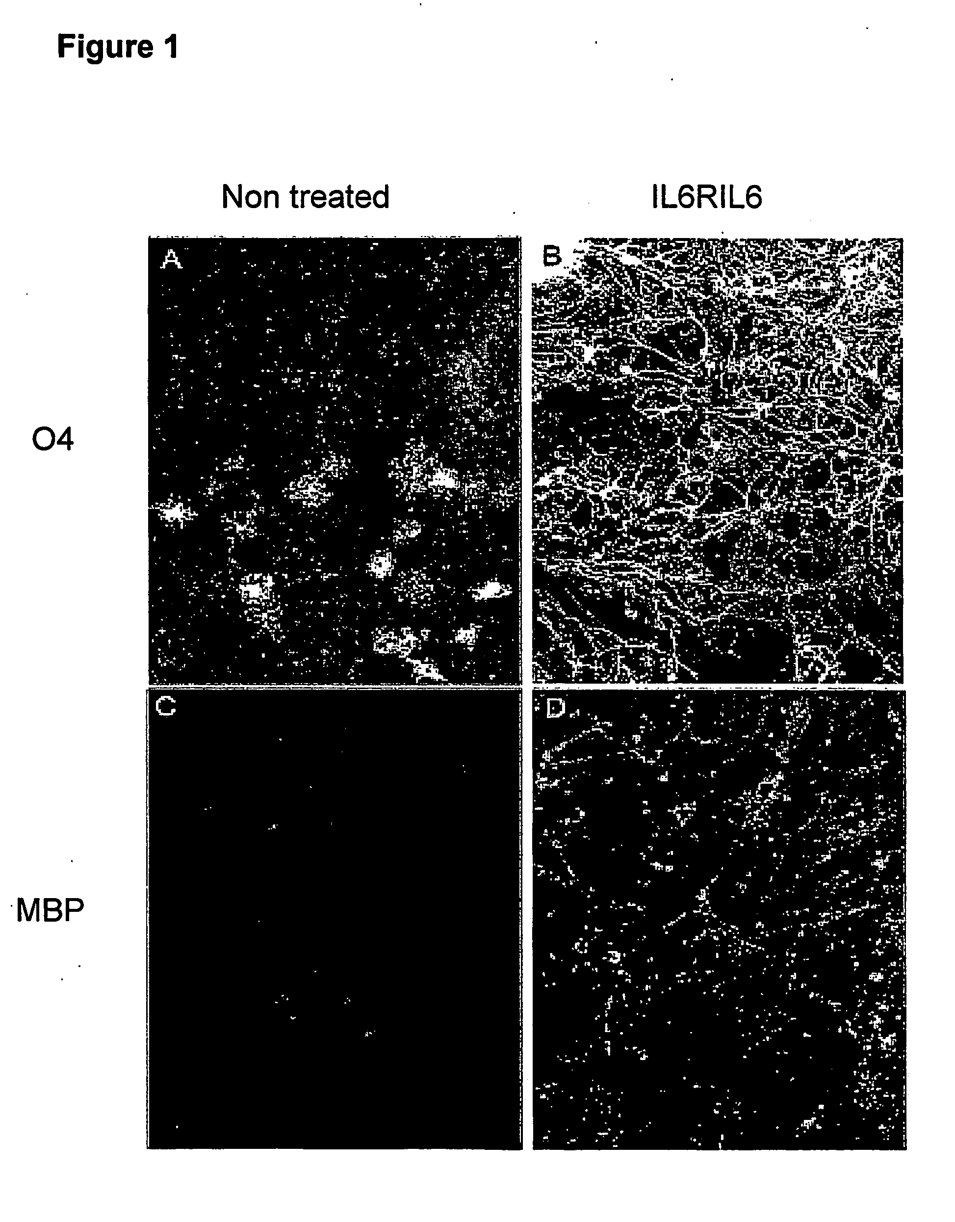 Enhancement of oligodendrocyte differrentiation