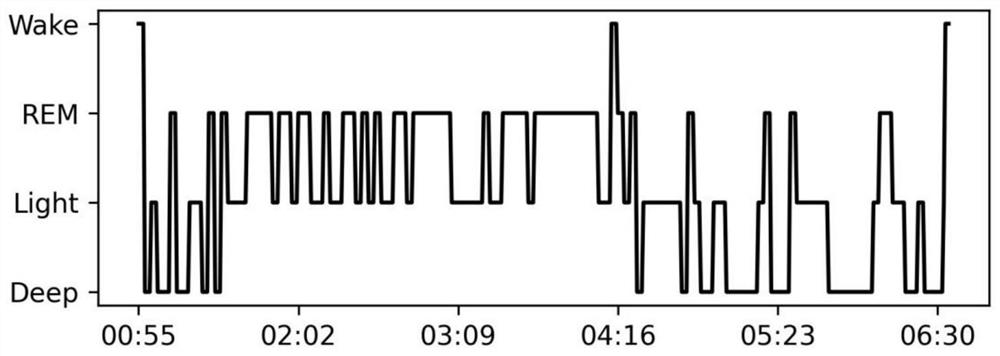 Machine learning algorithm for sleep staging by applying prefrontal lobe single-channel electroencephalogram signals