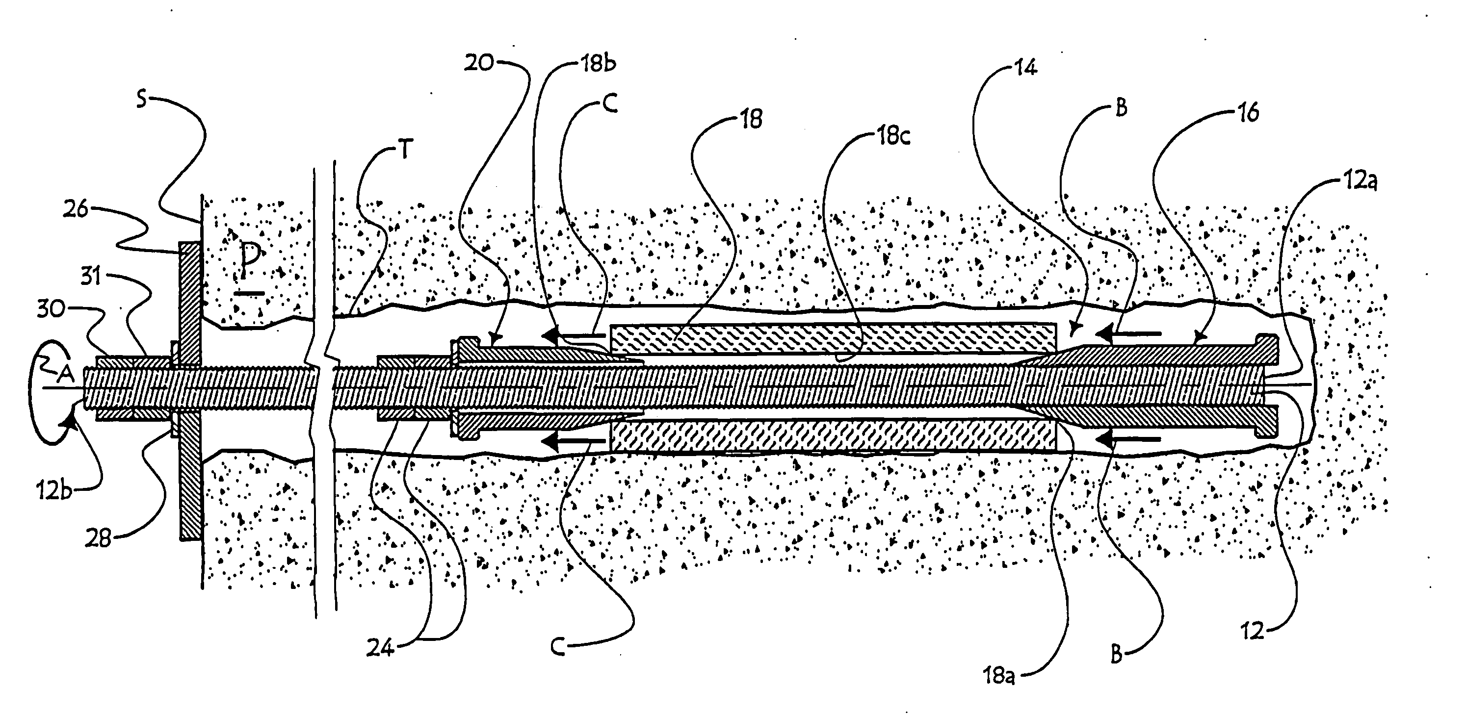 Anchor device with an elastic expansion sleeve