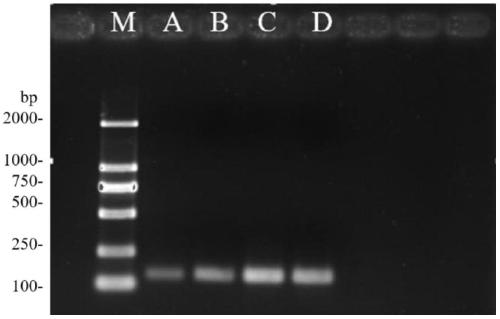 RPA (recombinase polymerase amplification) method for diagnosis and pathogen detection of blood flesh disease of watermelons