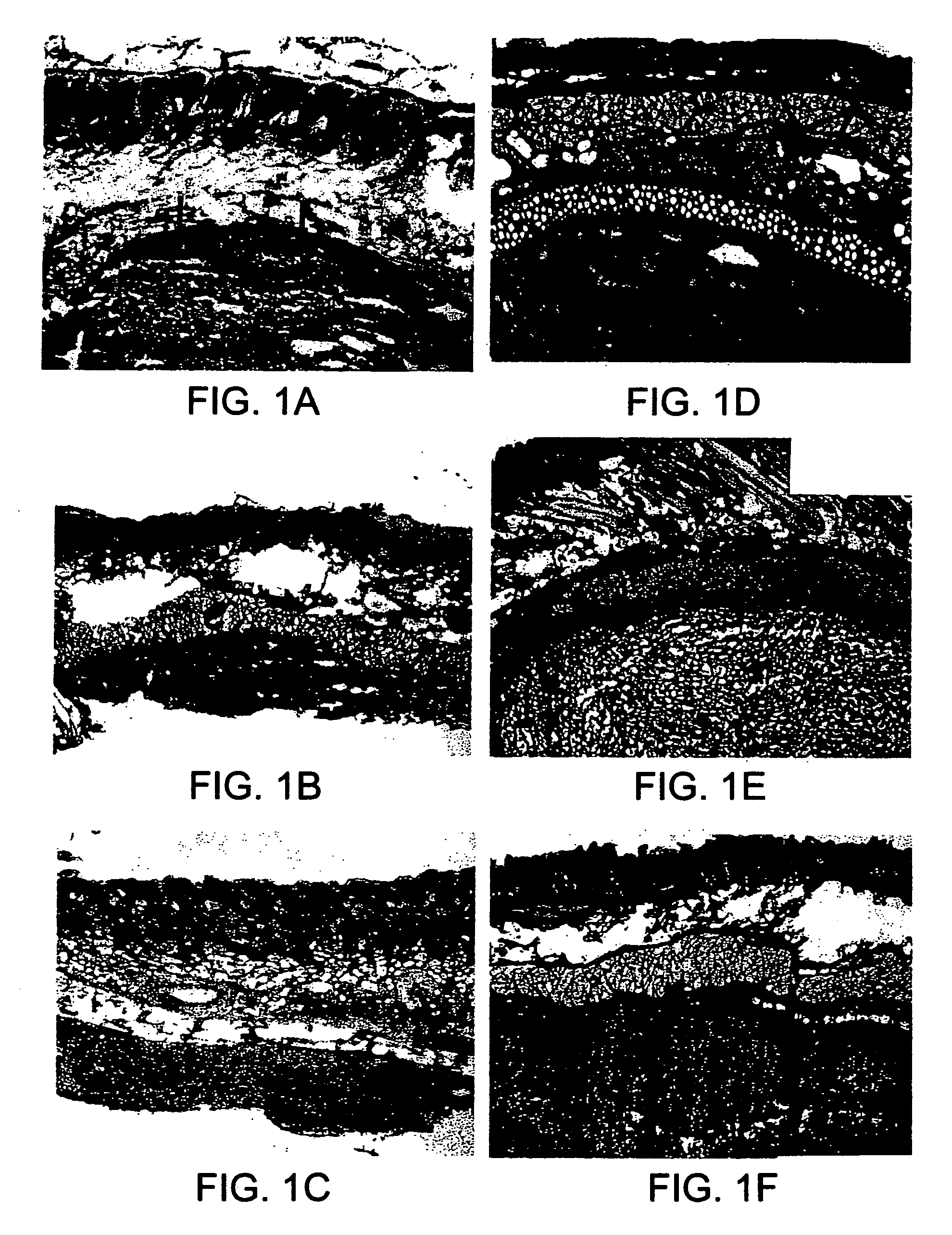 Soft tissue and bone augmentation and bulking utilizing muscle-derived progenitor cells, compositions and treatments thereof