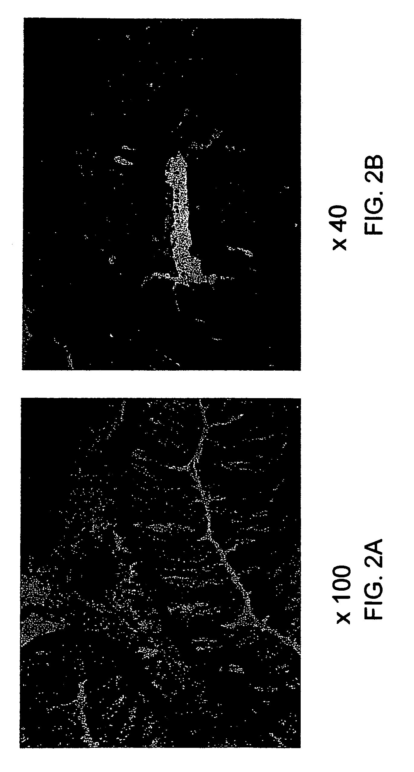 Soft tissue and bone augmentation and bulking utilizing muscle-derived progenitor cells, compositions and treatments thereof