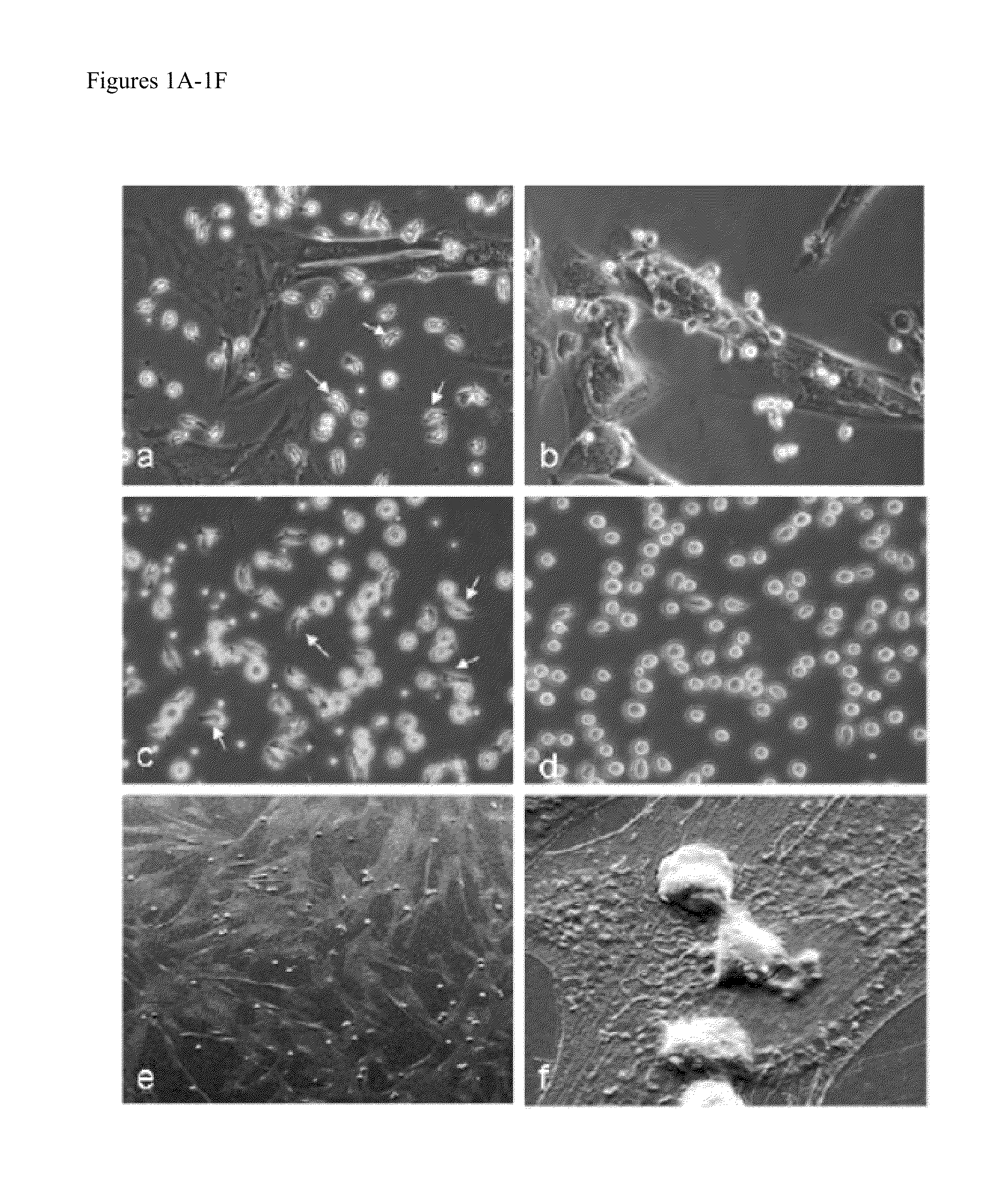 Wharton's Jelly Mesenchymal Stem Cells and Uses Thereof