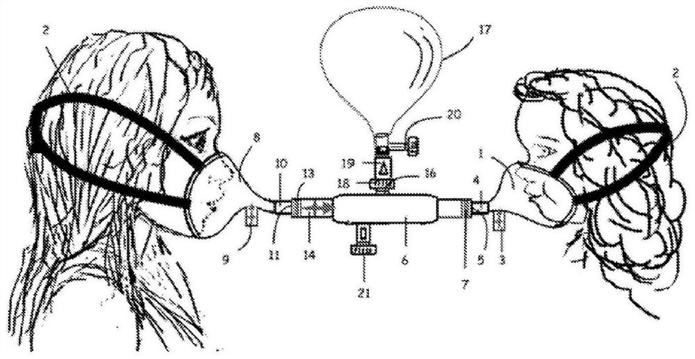 Device for speech therapy, administration of inhalation medication and for treatment of otitis, sinusitis and barotrauma